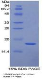 Human Tissue Factor Pathway Inhibitor (TFPI) Protein