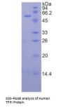 Human Tissue Factor Pathway Inhibitor (TFPI) Protein