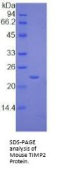 Mouse Metalloproteinase Inhibitor 2 (TIMP2) Protein