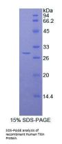 Human Titin (TTN) Protein