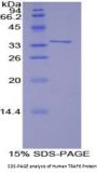 Human TNF Receptor Associated Factor 6 (TRAF6) Protein