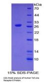 Human Toll Like Receptor 6 (TLR6) Protein