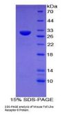 Mouse Toll Like Receptor 6 (TLR6) Protein