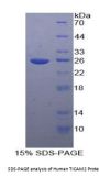 Human Intercellular Adhesion Molecule 2 / CD102 (ICAM2) Protein