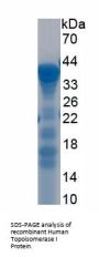 Human Topoisomerase I (TOP1) Protein