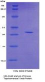 Mouse Topoisomerase II Beta (TOP2b) Protein