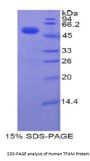 Human Transcription Factor A, Mitochondrial (TFAM) Protein