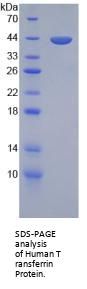 Human Transferrin (TF) Protein