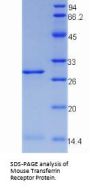 Mouse Transferrin Receptor Protein 1 / CD71 (TFRC) Protein