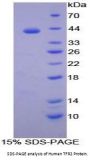 Human Transferrin Receptor Protein 2 (TFR2) Protein