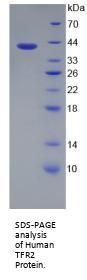 Human Transferrin Receptor Protein 2 (TFR2) Protein