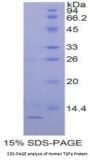 Human Transforming Growth Factor Alpha (TGFA) Protein