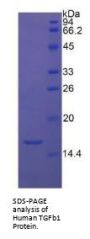 Human Transforming Growth Factor Beta 1 (TGFb1) Protein