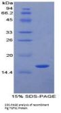 Pig Transforming Growth Factor Beta 1 (TGFb1) Protein