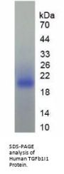 Human Transforming Growth Factor Beta 1 Induced Transcript 1 (TGFb1I1) Protein