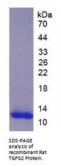 Rat Transforming Growth Factor Beta 2 (TGFb2) Protein