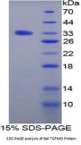 Rat Transforming Growth Factor Beta Receptor III (TGFbR3) Protein