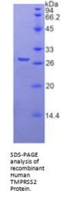 Human Transmembrane Protease, Serine 2 (TMPRSS2) Protein