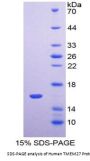 Human Transmembrane Protein 27 (TMEM27) Protein