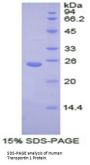 Human Transportin 1 (TNPO1) Protein
