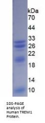 Human Triggering Receptor Expressed On Myeloid Cells 1 (TREM1) Protein