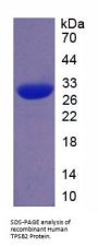 Human Tryptase Beta 2 (TPSB2) Protein