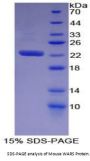 Mouse Tryptophanyl tRNA Synthetase (WARS) Protein