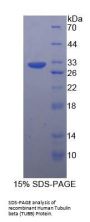 Human Tubulin Beta (TUBB) Protein