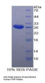 Human Tubulin Polymerization Promoting Protein (TPPP) Protein