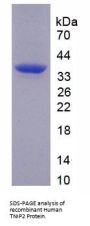 Human Tumor Necrosis Factor Alpha Induced Protein 3 Interacting Protein 2 (TNIP2) Protein