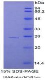 Rat Tumor Necrosis Factor Alpha Induced Protein 3 Interacting Protein 2 (TNIP2) Protein