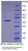 Human Lymphotoxin Alpha (LTA) Protein