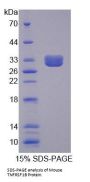 Mouse Tumor Necrosis Factor Receptor Superfamily Member 1B / CD120b (TNFRSF1B) Protein