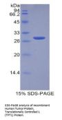 Human Tumor Protein, Translationally Controlled 1 (TPT1) Protein