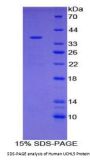 Human Ubiquitin Carboxyl Terminal Hydrolase L5 (UCHL5) Protein