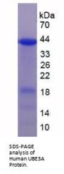 Human Ubiquitin Protein Ligase E3A (UBE3A) Protein