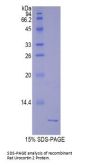 Rat Urocortin 2 (UCN2) Protein