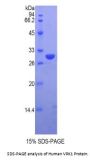 Human Vaccinia Related Kinase 1 (VRK1) Protein