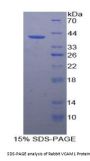 Rabbit Vascular Cell Adhesion Molecule 1 (VCAM1) Protein