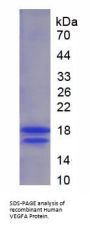 Human Vascular Endothelial Growth Factor A (VEGFA) Protein