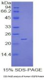 Human Vascular Endothelial Growth Factor B (VEGFB) Protein