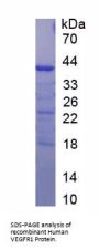 Human Vascular Endothelial Growth Factor Receptor 1 / VEGFR1 (FLT1) Protein
