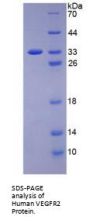 Human Vascular Endothelial Growth Factor Receptor 2 / VEGFR2 (KDR) Protein