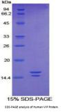 Human Vasoactive Intestinal Peptide (VIP) Protein