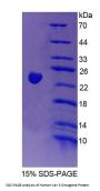 Human Vav 3 Oncogene (VAV3) Protein