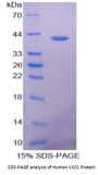 Human C-X-C Motif Chemokine 17 (CXCL17) Protein