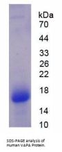 Human Vesicle Associated Membrane Protein Associated Protein A (VAPA) Protein