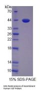 Human VGF Nerve Growth Factor Inducible (VGF) Protein