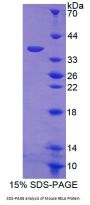Mouse Transcription Factor p65 / NFKB3 (RELA) Protein