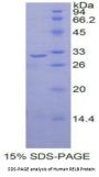 Human V-Rel Reticuloendotheliosis Viral Oncogene Homolog B (RELB) Protein